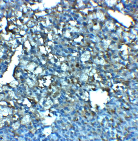 LRRC8A Antibody - BSA Free