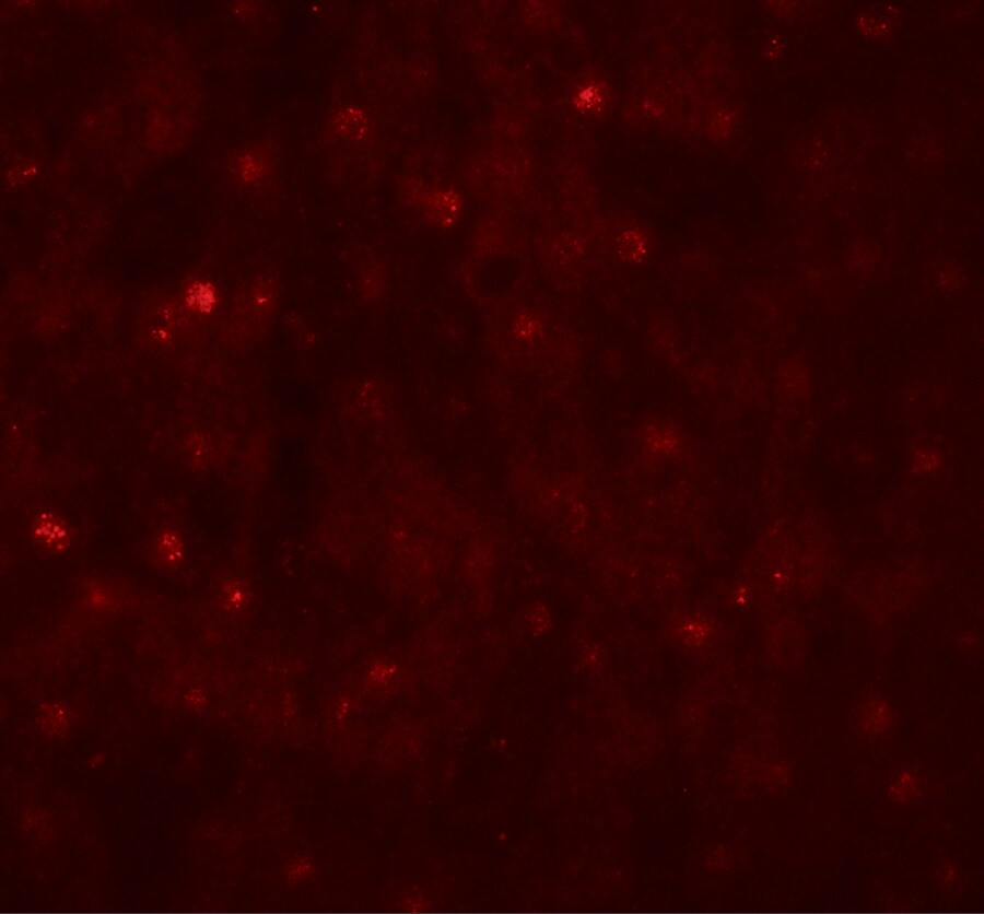 TCTEX1D4 Antibody - BSA Free