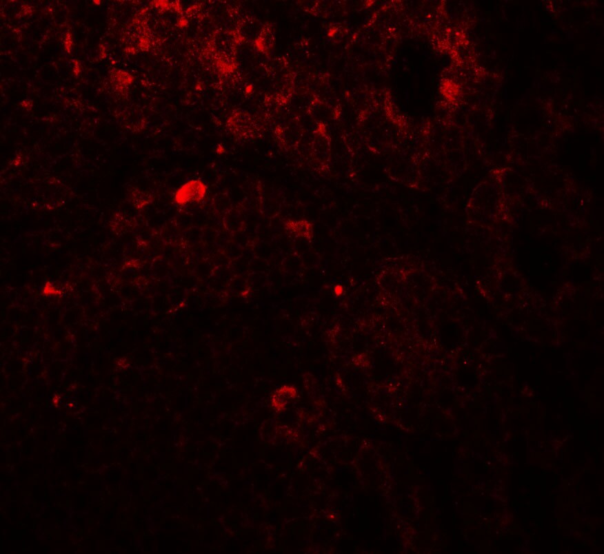 Thyroid receptor-interacting protein 12 Antibody - BSA Free