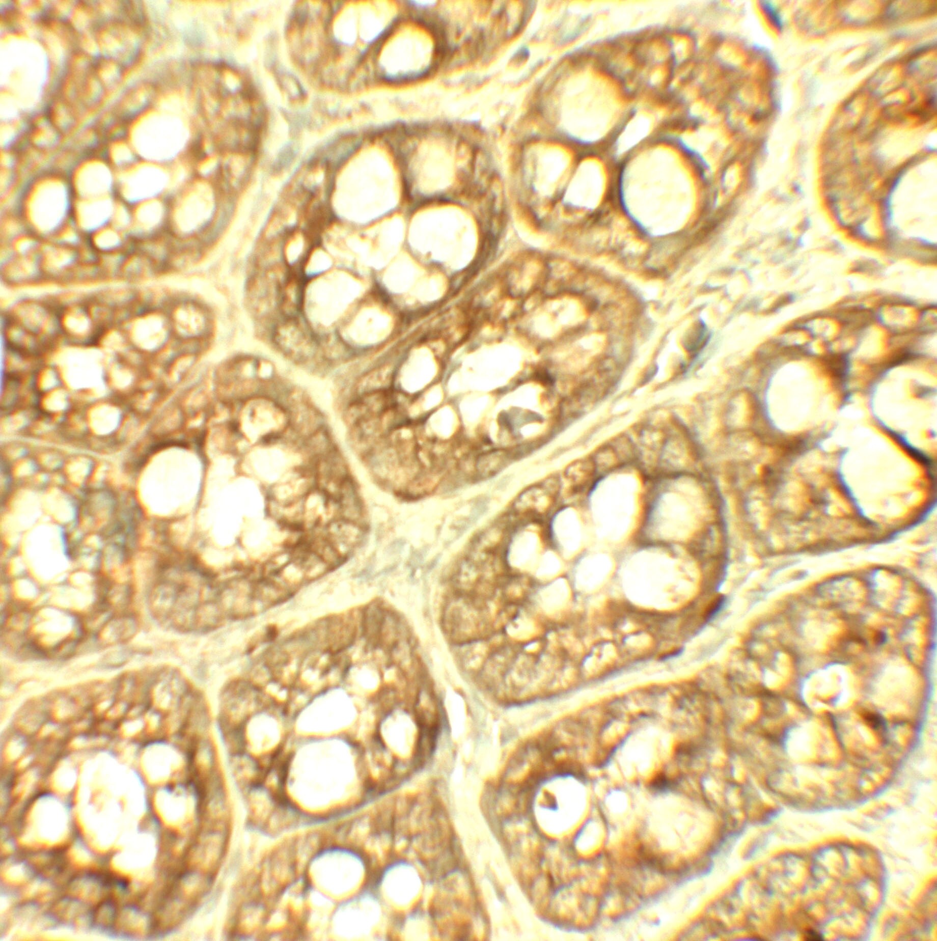Thyroid receptor-interacting protein 12 Antibody - BSA Free