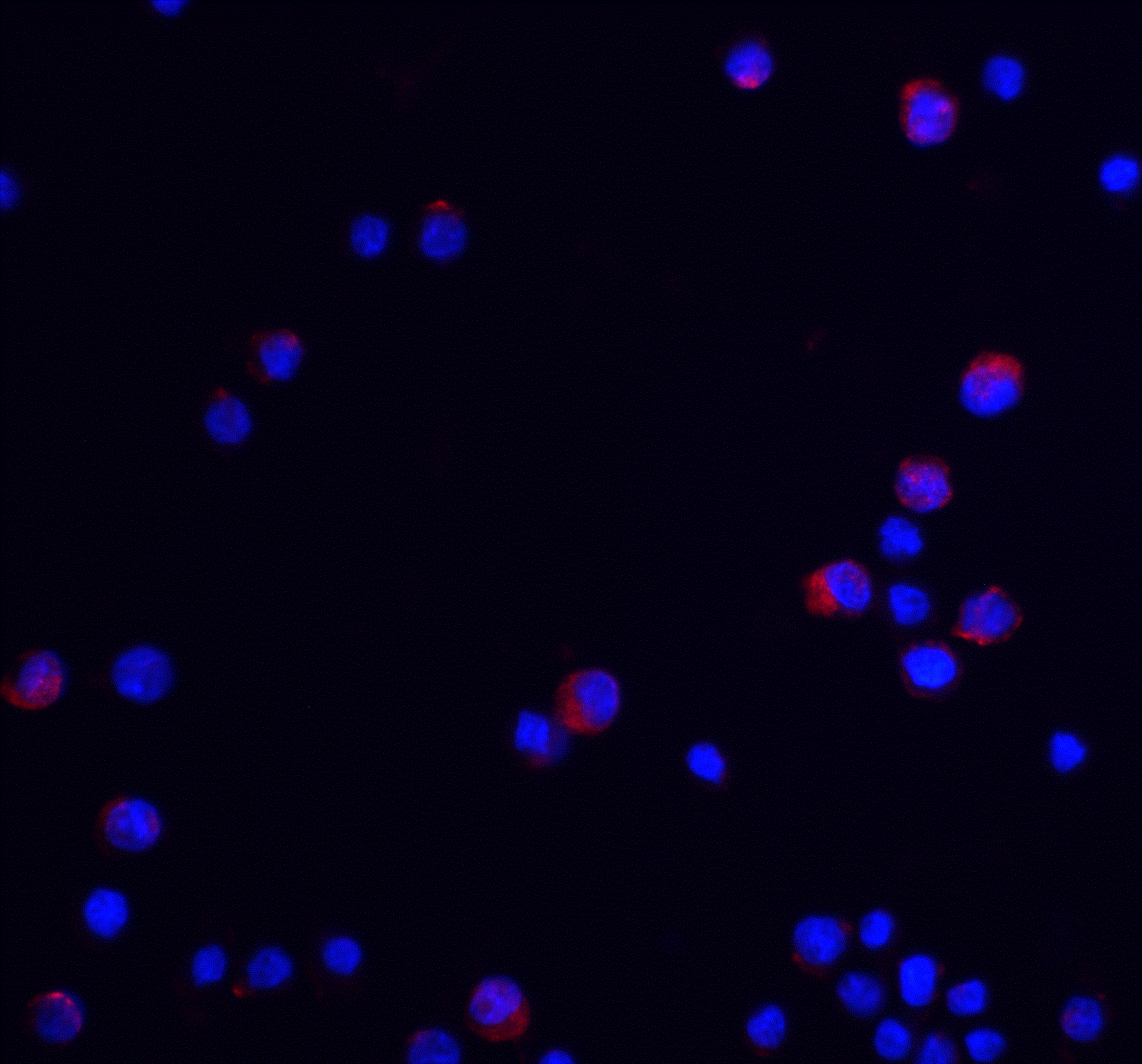 UBAP2L Antibody - BSA Free
