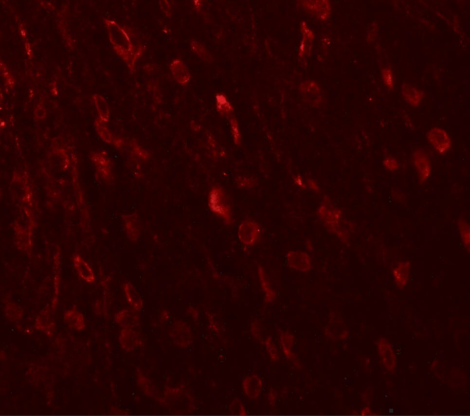 ZNF537 Antibody - BSA Free