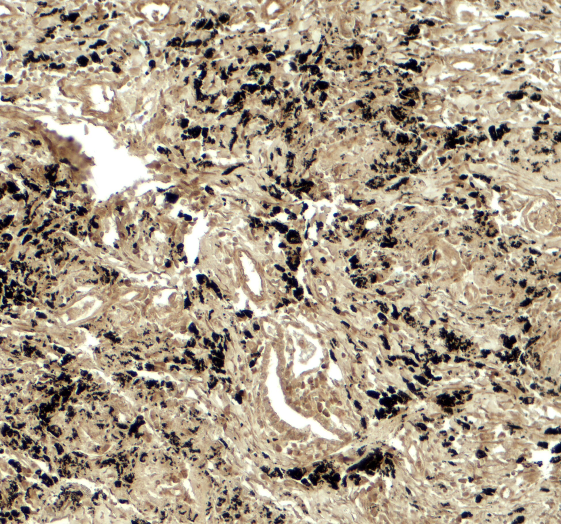 PPM1D Antibody - BSA Free