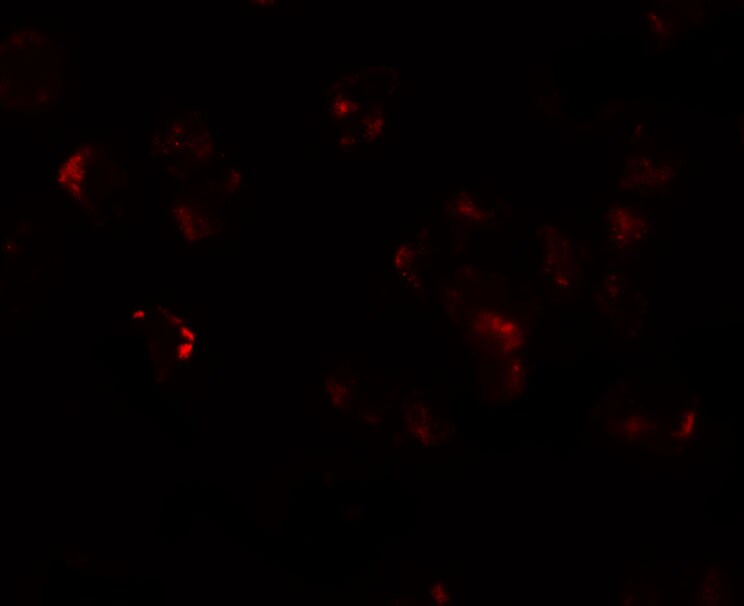 AFAP1L1 Antibody - BSA Free