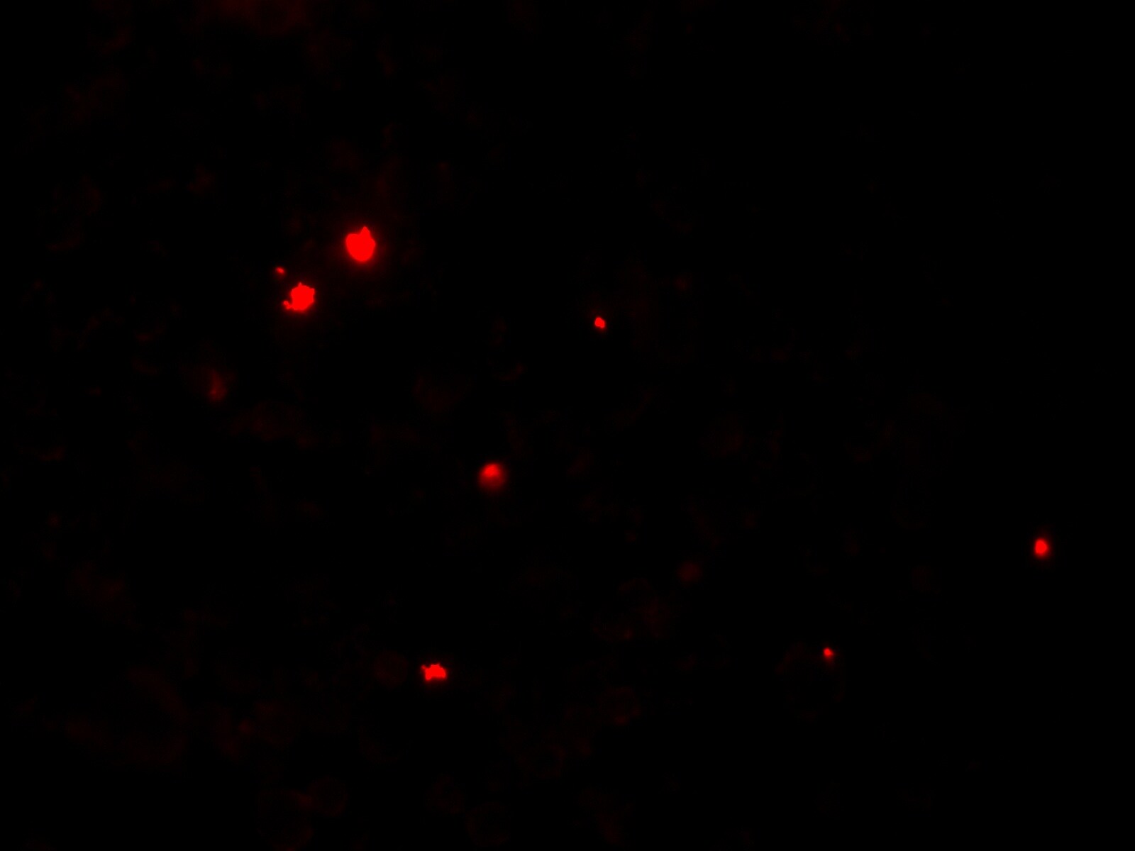 RNASET2 Antibody - BSA Free