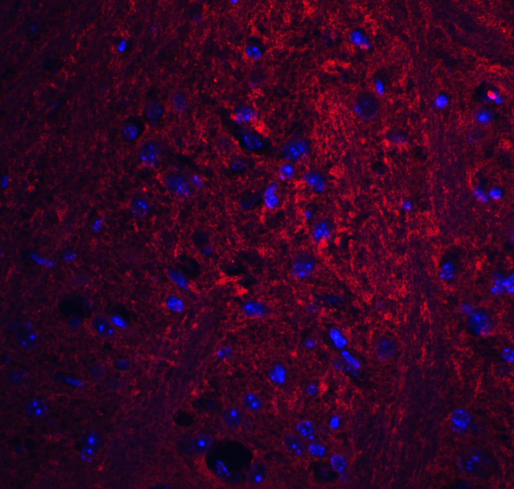 GSAP Antibody - BSA Free