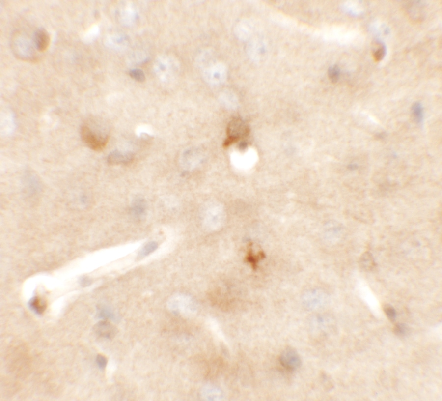 CCDC141 Antibody - BSA Free