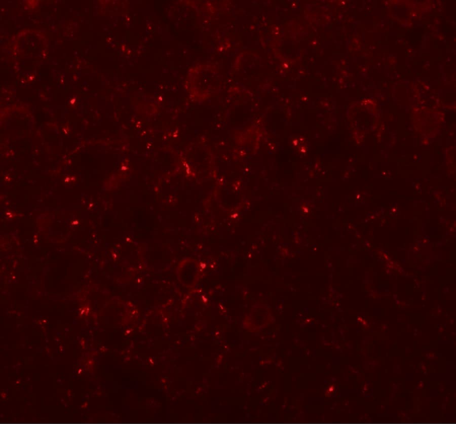 CCDC141 Antibody - BSA Free