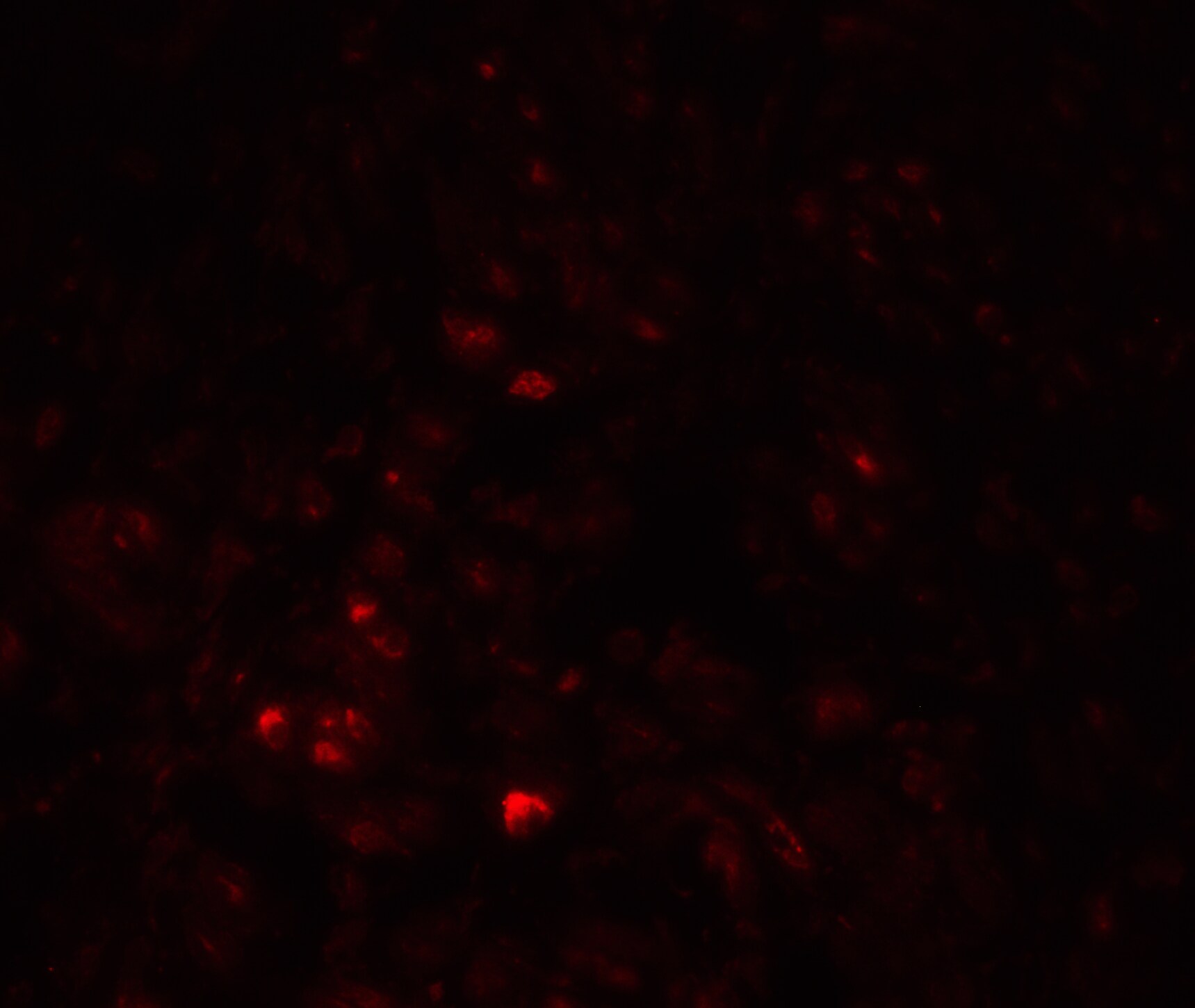 CAPC / LRRC26 Antibody - BSA Free