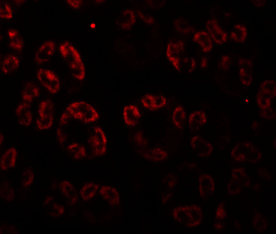 SKIV2L Antibody - BSA Free