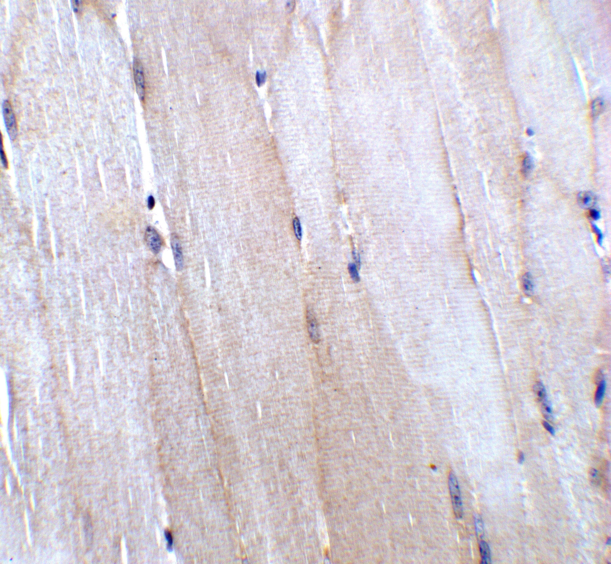 CHADL Antibody - BSA Free