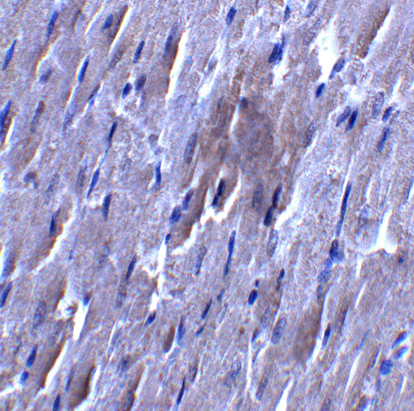 FATP6/SLC27A6 Antibody - BSA Free
