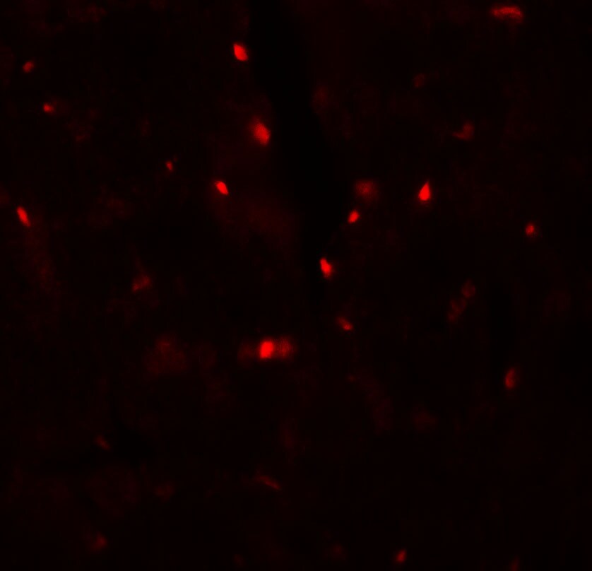 FATP6/SLC27A6 Antibody - BSA Free