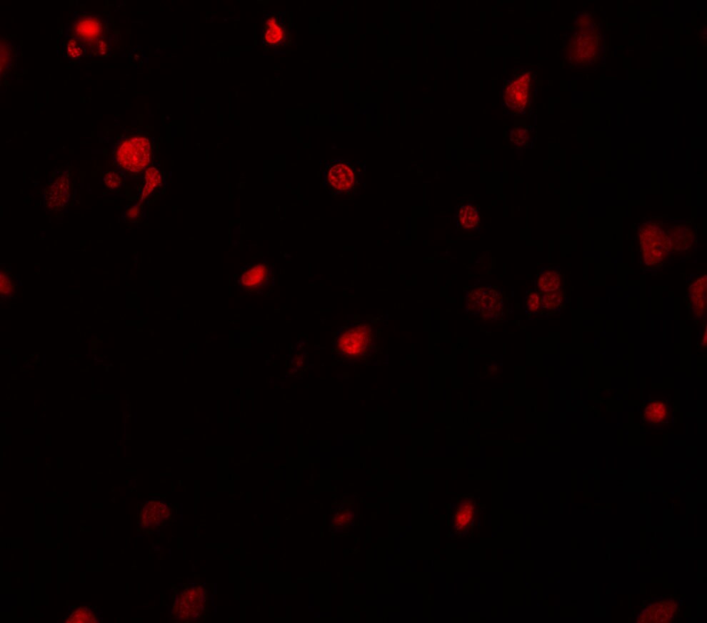 Death Ligand Signal Enhancer Antibody - BSA Free