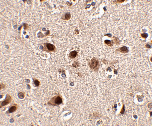 SLITRK5 Antibody - BSA Free