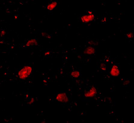 SLITRK5 Antibody - BSA Free