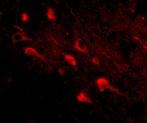 SLITRK5 Antibody - BSA Free