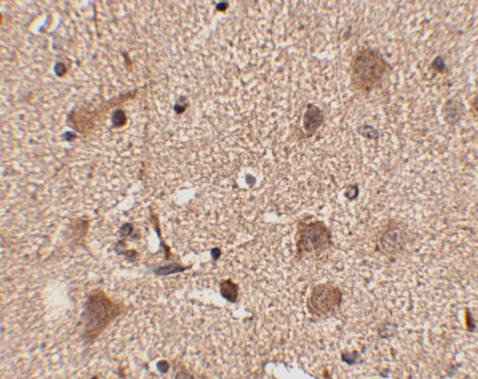 SLITRK5 Antibody - BSA Free