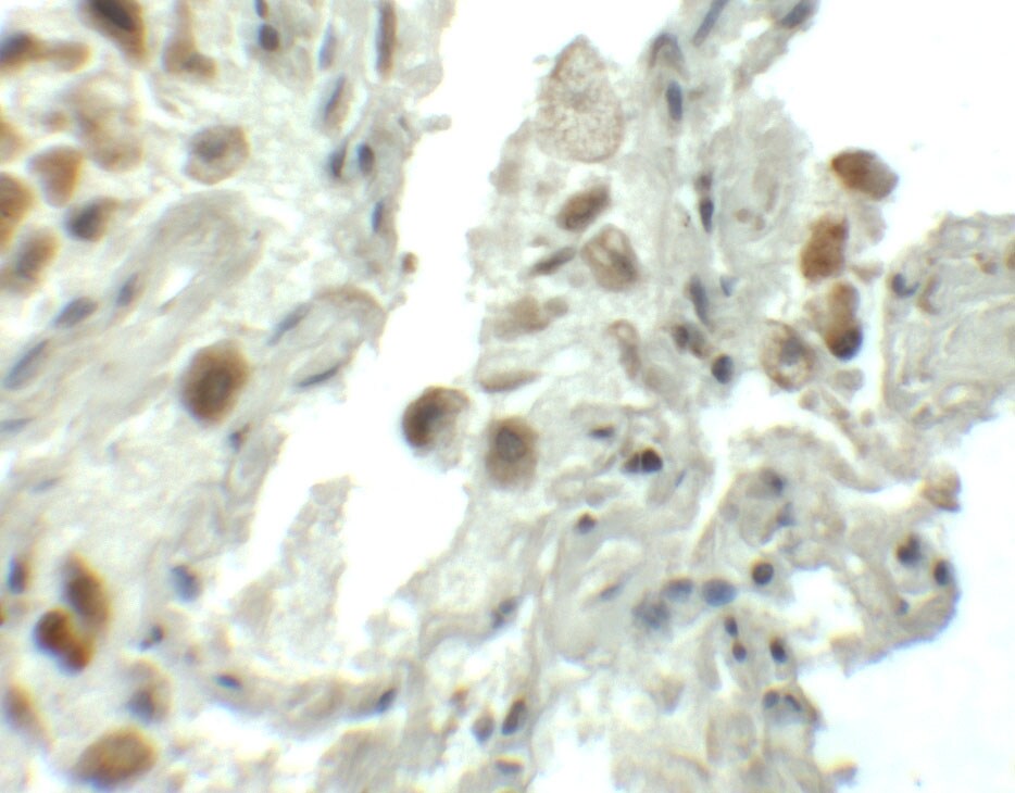SPTLC1 Antibody - BSA Free