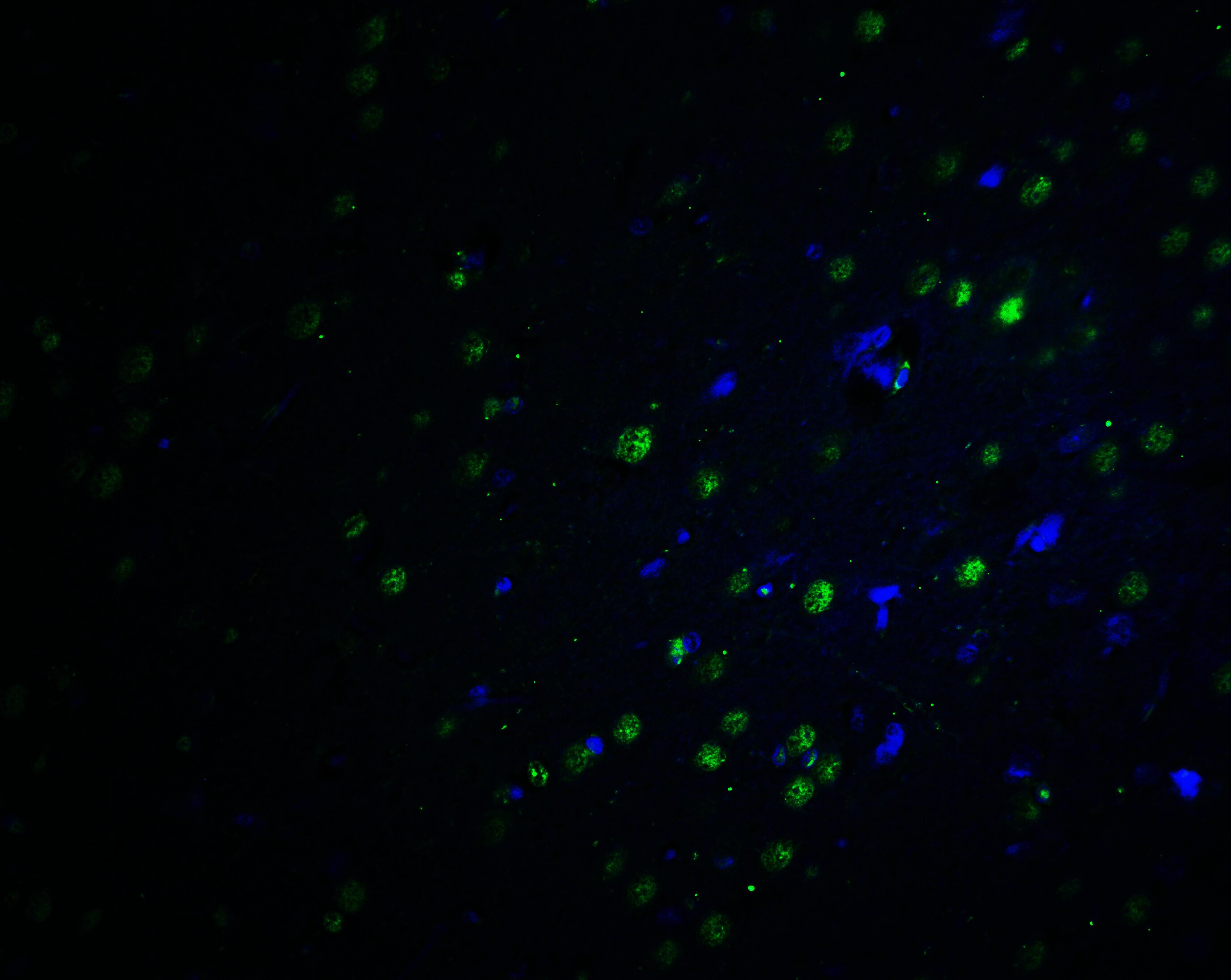 PLAGL2 Antibody - BSA Free