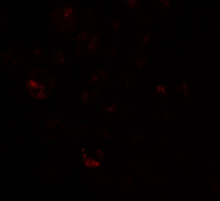 PRICKLE4 Antibody - BSA Free