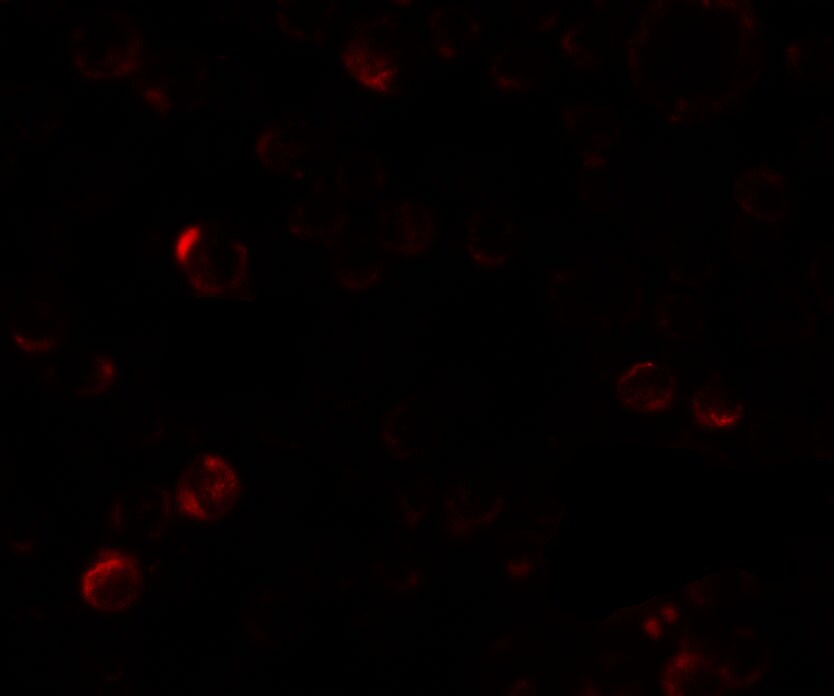 Laforin/EPM2A Antibody - BSA Free