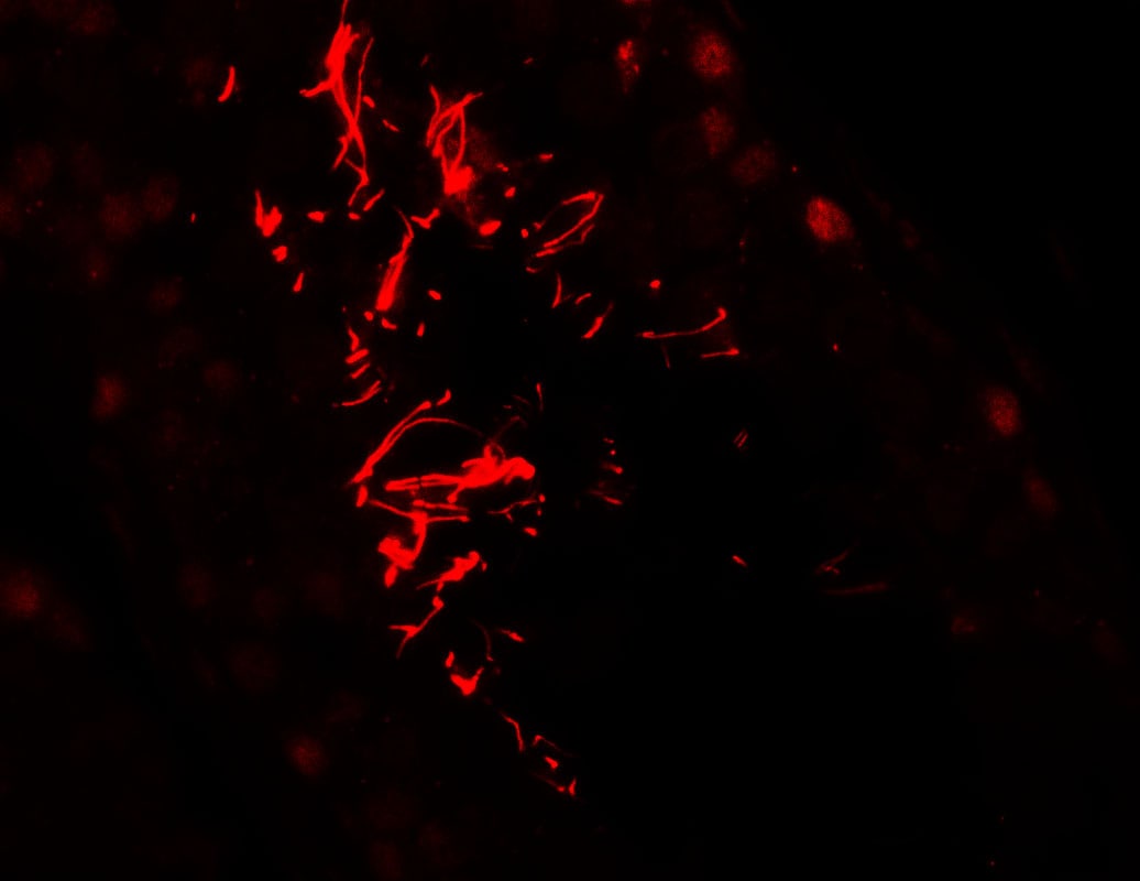 AKAP4 Antibody - BSA Free