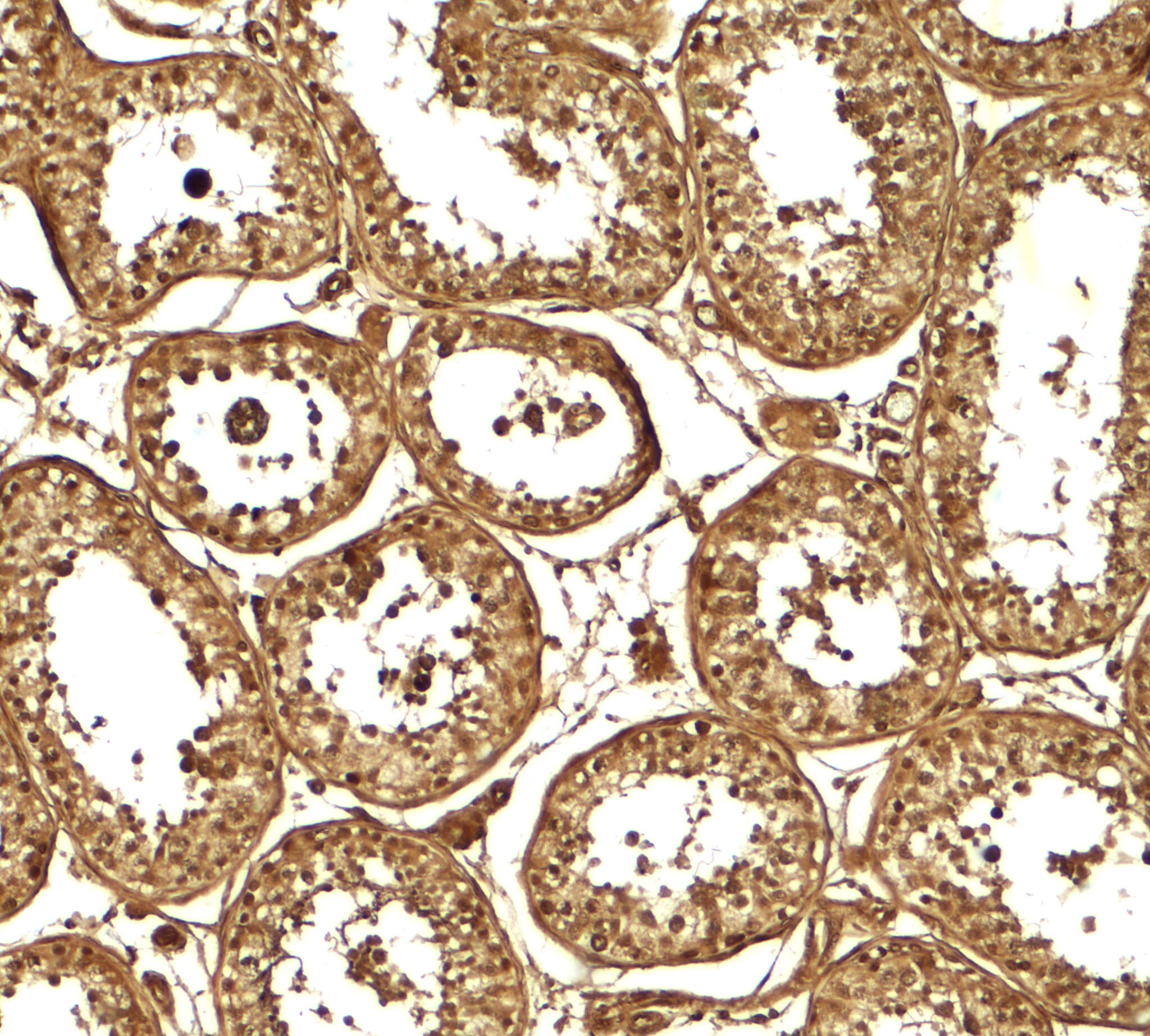 AKAP4 Antibody - BSA Free
