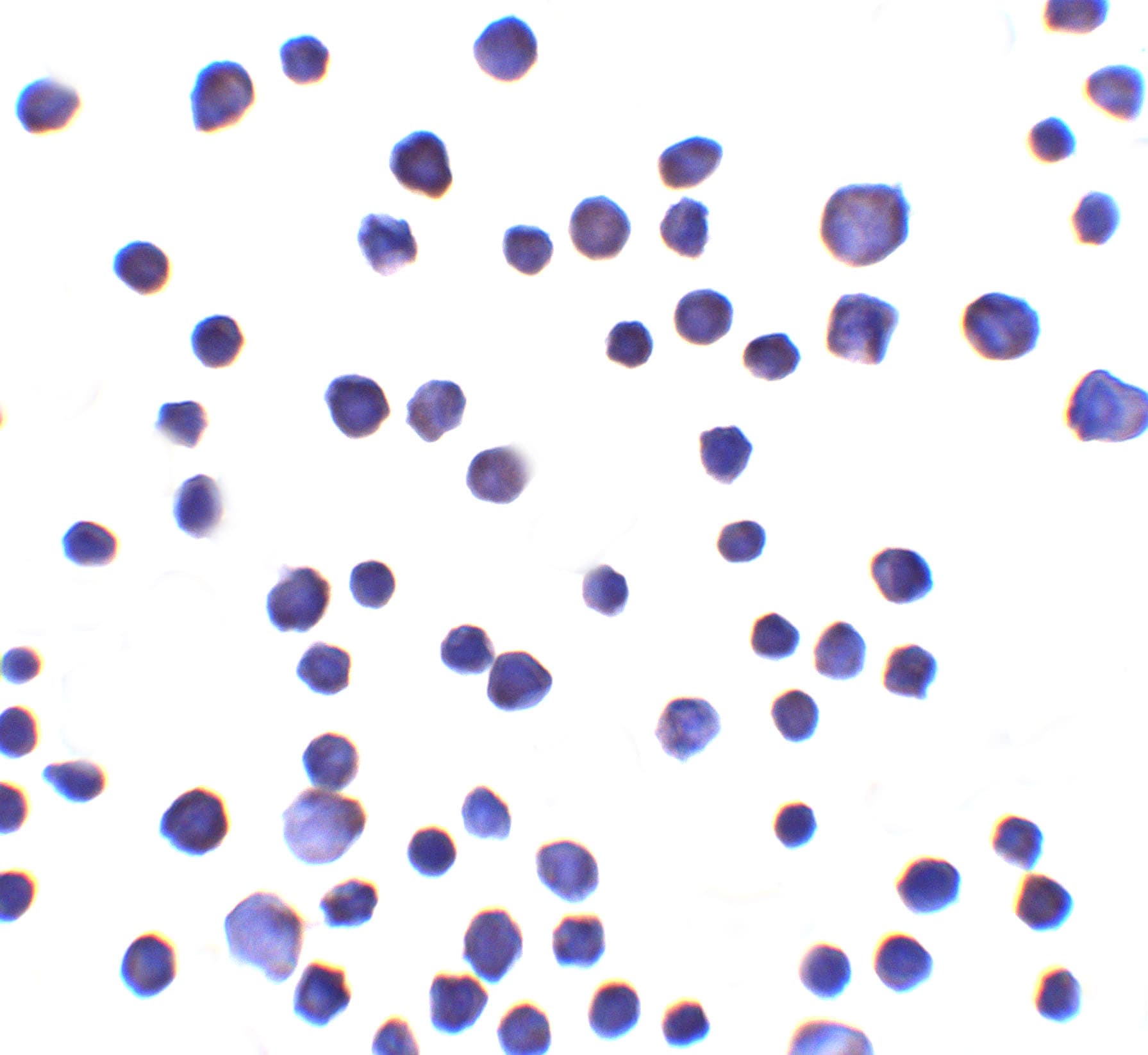 RNF121 Antibody - BSA Free