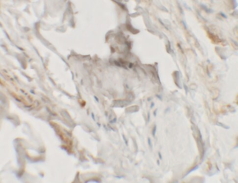 HHATL Antibody - BSA Free