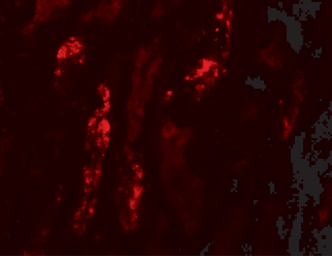 ANKRD15 Antibody - BSA Free