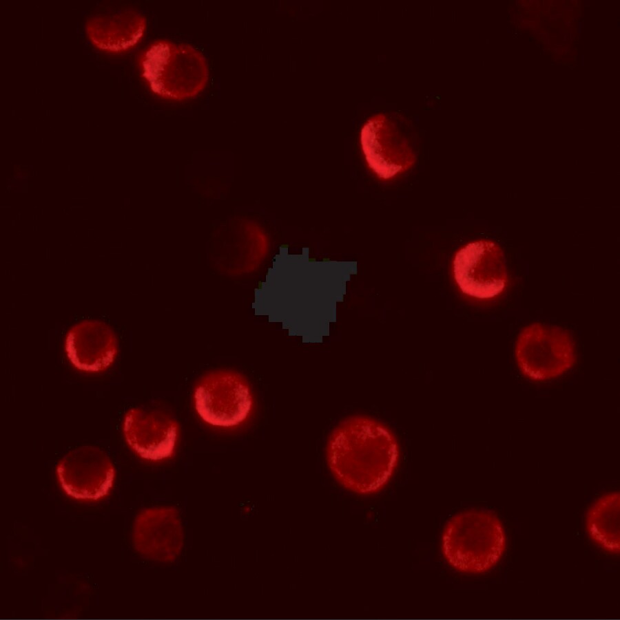 CASKIN2 Antibody - BSA Free