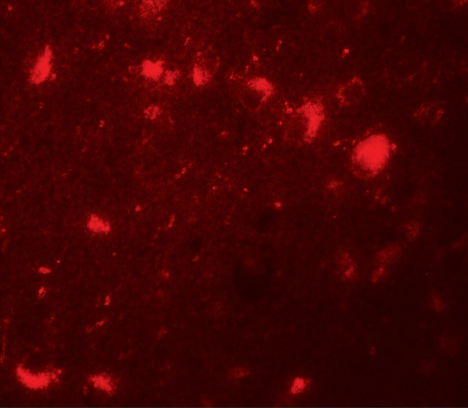 CBX4 Antibody - BSA Free