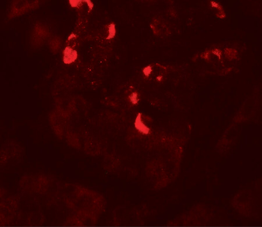 GLIPR1L1 Antibody - BSA Free