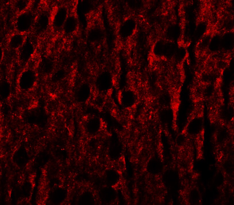 RILPL1 Antibody - BSA Free