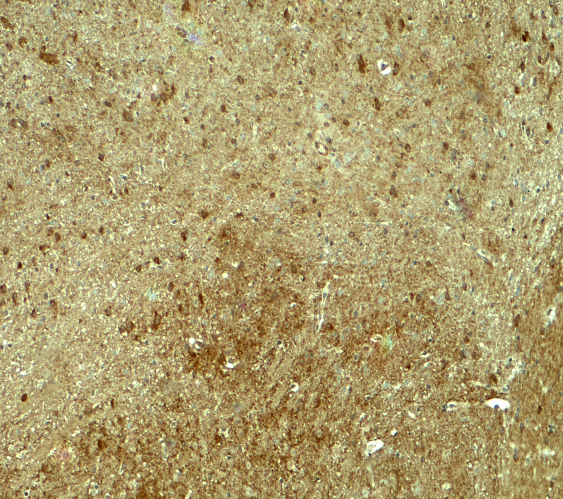 RNF70 Antibody - BSA Free