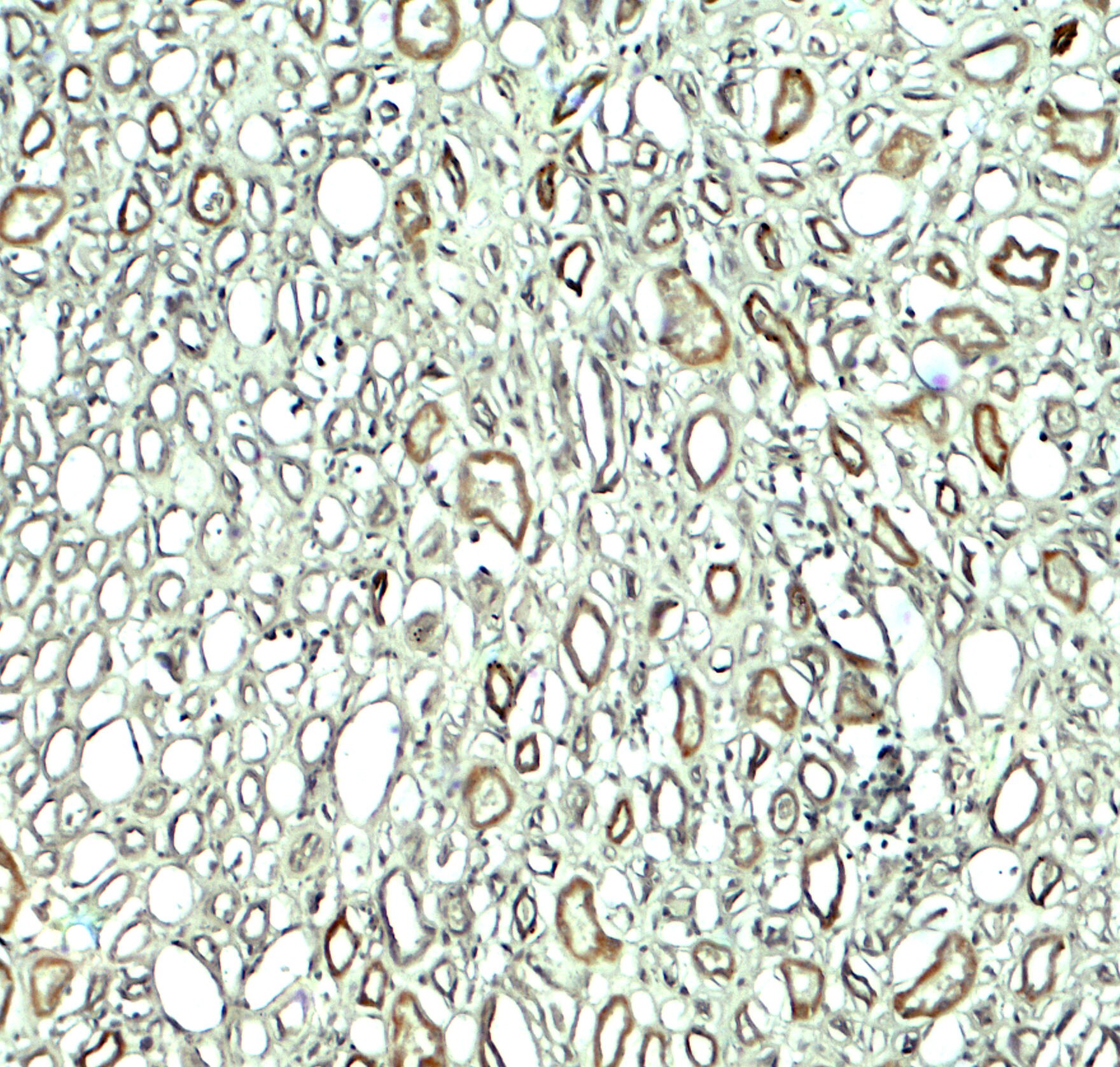 Rubicon Antibody - BSA Free