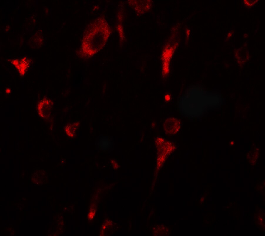 SGSM2 Antibody - BSA Free