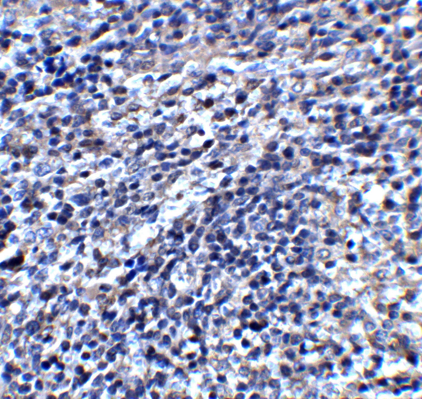 ORAI3 Antibody - BSA Free
