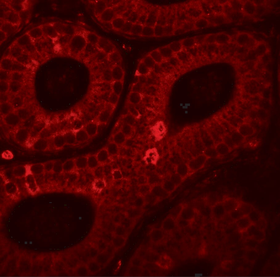 SPINK2 Antibody - BSA Free