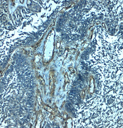 PALMD Antibody - BSA Free
