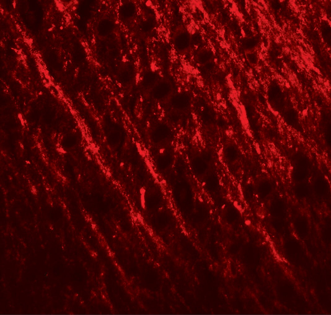 PRRT2 Antibody - BSA Free