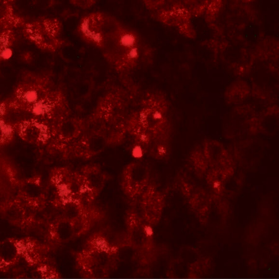 TMEM106B Antibody - BSA Free
