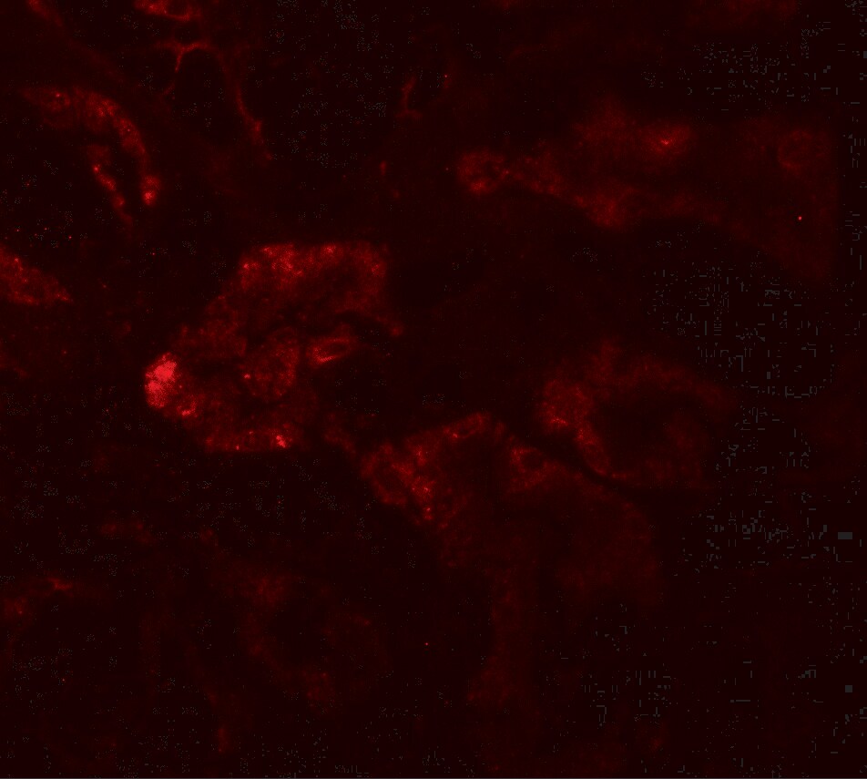 RAB21 Antibody - BSA Free
