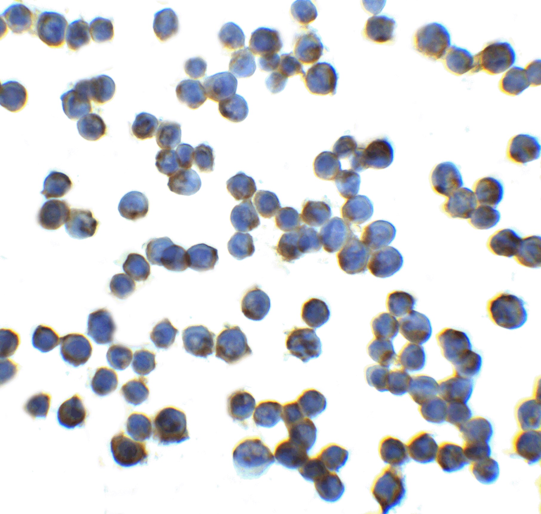 RFX1 Antibody - BSA Free