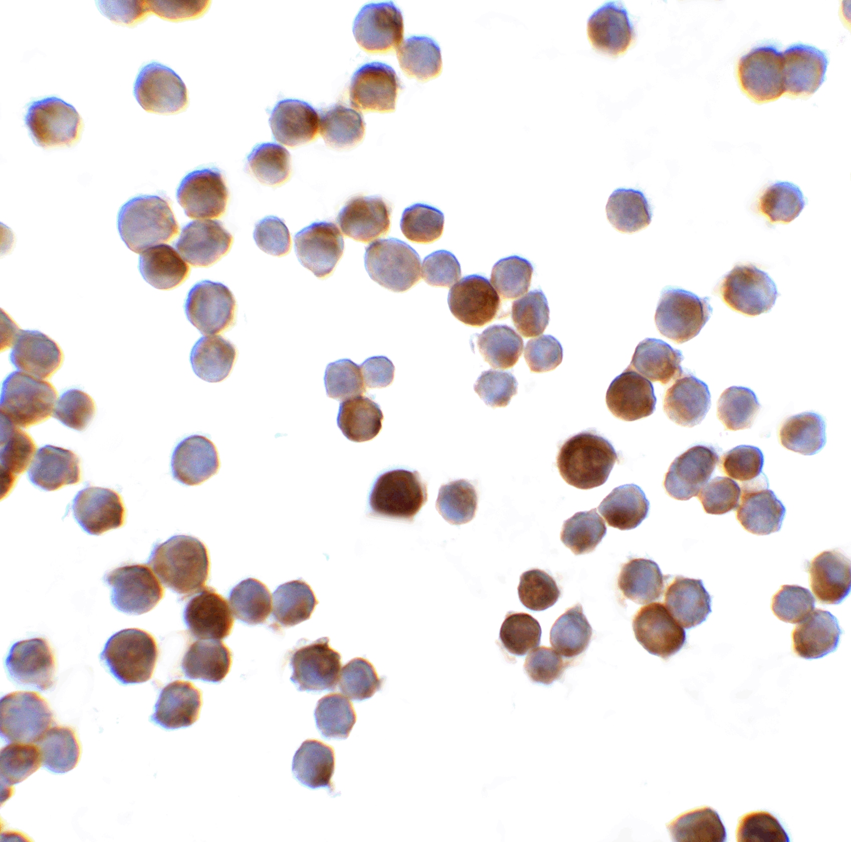 RFX1 Antibody - BSA Free