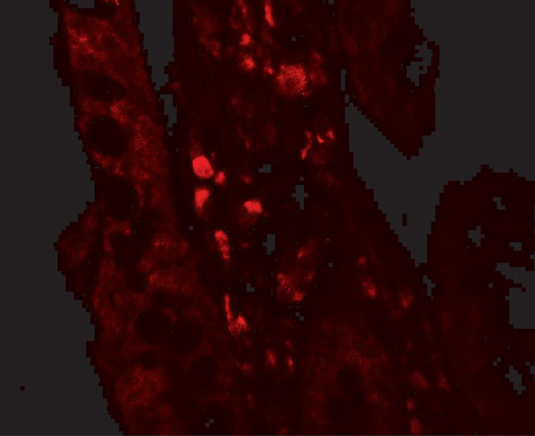 RTVP-1/GLIPR1 Antibody - BSA Free