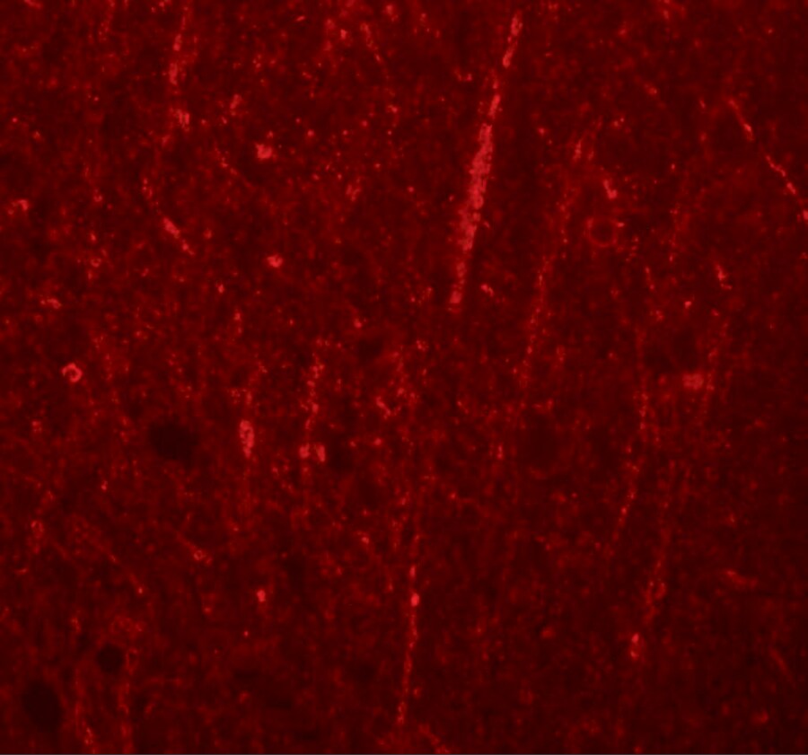 Preso/FRMPD4 Antibody - BSA Free