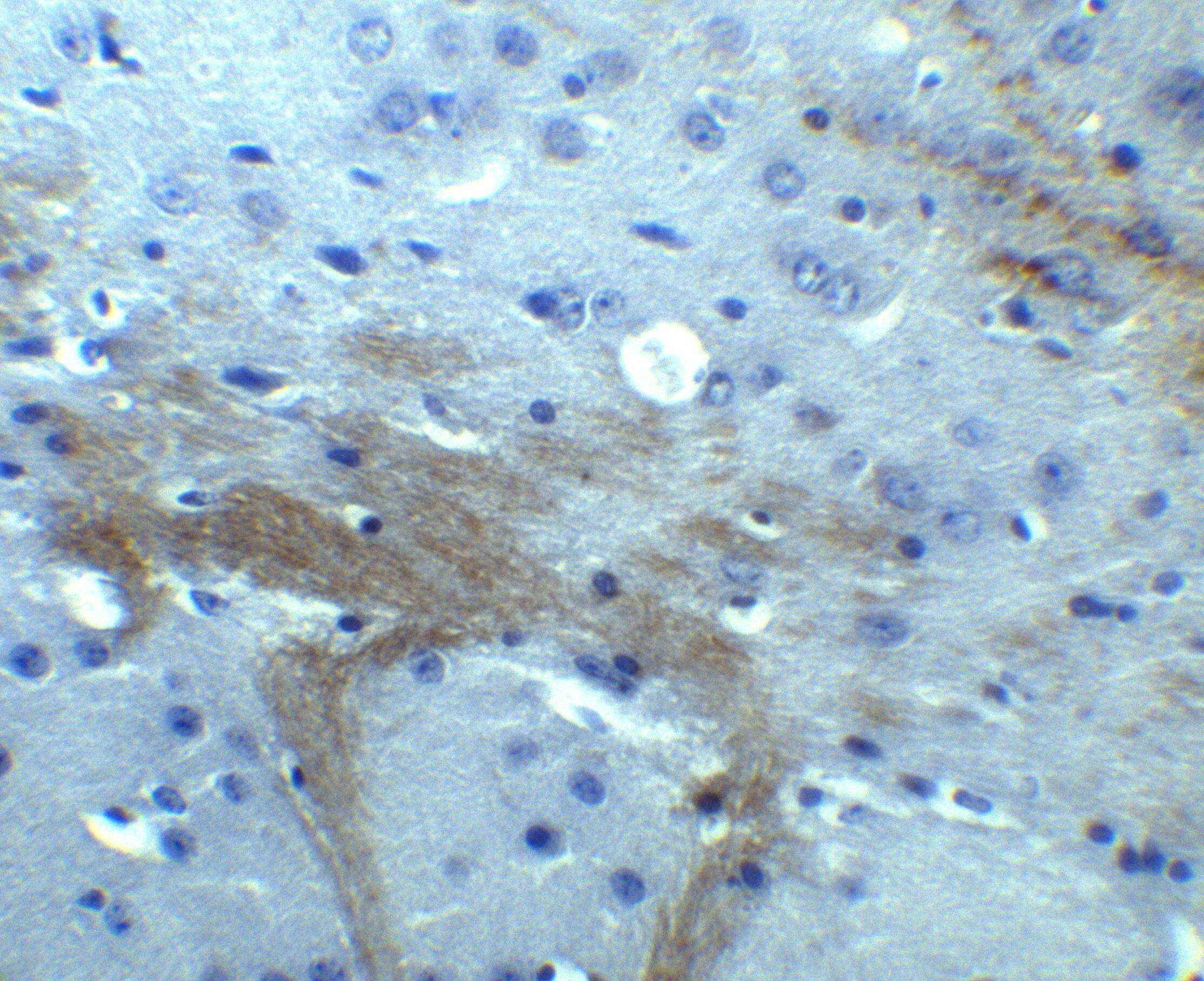 TNFAIP1 Antibody - BSA Free