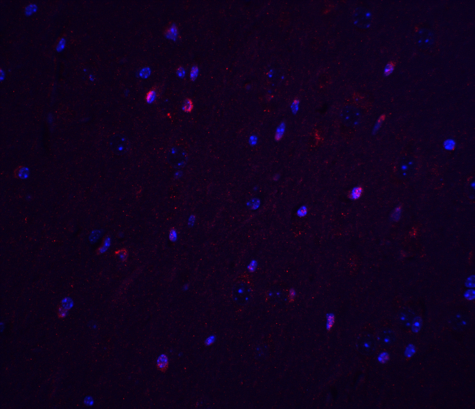 TNFAIP1 Antibody - BSA Free